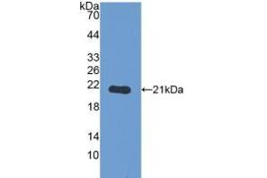 Detection of Recombinant PYGL, Human using Polyclonal Antibody to Glycogen Phosphorylase, Liver (PYGL)