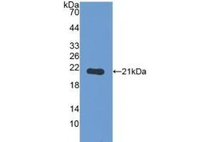 PYGL anticorps  (AA 370-538)