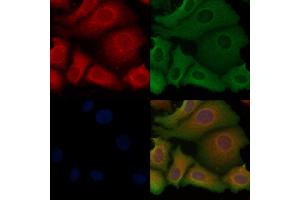 ABIN6254917 and ABIN6267068 staining Hela cells by IF/ICC.