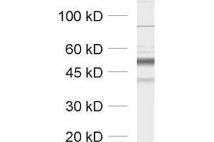 dilution: 1 : 1000, sample: unboiled synaptic membrane fraction of rat brain (LP1)