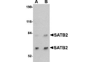 Western Blotting (WB) image for anti-SATB Homeobox 2 (SATB2) (C-Term) antibody (ABIN1030643) (SATB2 anticorps  (C-Term))