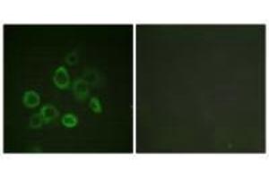 Immunofluorescence analysis of LOVO cells, using Bax (Ab-167) antibody.