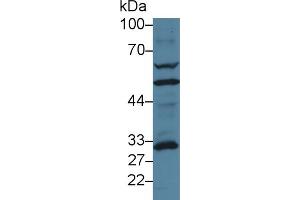 Detection of GCLM in Human MCF7 cell lysate using Polyclonal Antibody to Glutamate Cysteine Ligase, Modifier Subunit (GCLM) (GCLM anticorps  (AA 40-251))