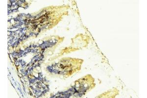 ABIN6276842 at 1/100 staining Mouse colon tissue by IHC-P.
