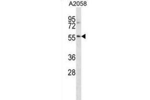 Western Blotting (WB) image for anti-BTB (POZ) Domain Containing 14A (BTBD14A) antibody (ABIN2998943) (BTBD14A anticorps)