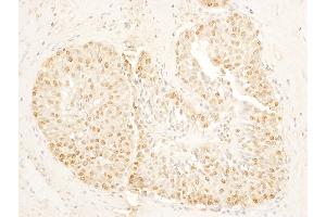 anti-Stromal Antigen 1 (STAG1) (AA 1125-1175) antibody