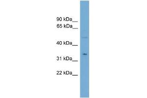 WB Suggested Anti-MGLL  Antibody Titration: 0. (MGLL anticorps  (N-Term))