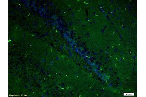 Formalin-fixed and paraffin-embedded rat brain labeled with Anti-ERK2/MAPK1 Polyclonal Antibody, Unconjugated (ABIN723725) 1:200, overnight at 4°C, The secondary antibody was Goat Anti-Rabbit IgG, FITC conjugated used at 1:200 dilution for 40 minutes at 37°C.