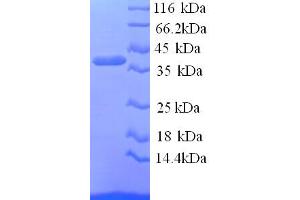 SDS-PAGE (SDS) image for Pregnancy Zone Protein (PZP) (AA 472-821), (partial) protein (His tag) (ABIN5713778) (PZP Protein (AA 472-821, partial) (His tag))