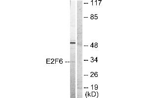Western blot analysis of extracts from HepG2 cells, usingantibody (#C0179). (E2F6 anticorps)