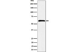 Western blot analysis of Syndecan 3 expression in K562 cell lysate.