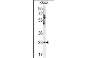 HSD11B1L Antibody (C-term) (ABIN655425 and ABIN2844963) western blot analysis in K562 cell line lysates (35 μg/lane). (HSD11B1L anticorps  (C-Term))