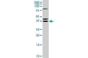 RDHE2 monoclonal antibody (M01), clone 3G8. (SDR16C5 anticorps  (AA 26-309))
