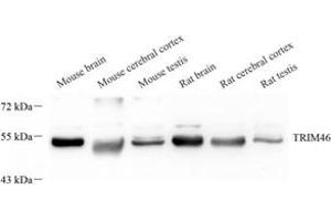 Western blot analysis of TRIM46 (ABIN7076020) at dilution of 1: 2000 (TRIM46 anticorps)