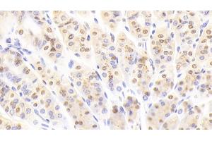Detection of NUP88 in Mouse Stomach Tissue using Polyclonal Antibody to Nucleoporin 88 (NUP88) (NUP88 anticorps  (AA 57-296))