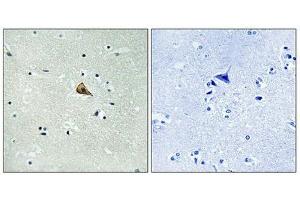 Immunohistochemistry analysis of paraffin-embedded human brain tissue using Trk A (Phospho-Tyr701) antibody.