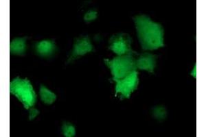 Anti-TMOD1 mouse monoclonal antibody (ABIN2454777) immunofluorescent staining of COS7 cells transiently transfected by pCMV6-ENTRY TMOD1 (RC201134). (Tropomodulin 1 anticorps)