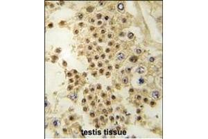 Formalin-fixed and paraffin-embedded human testis tissue reacted with LIN28A antibody (C-term) (ABIN6243718 and ABIN6578921) , which was peroxidase-conjugated to the secondary antibody, followed by DAB staining.