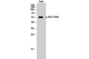 Western Blotting (WB) image for anti-V-Akt Murine Thymoma Viral Oncogene Homolog 1 (AKT1) (pThr308) antibody (ABIN3181908) (AKT1 anticorps  (pThr308))