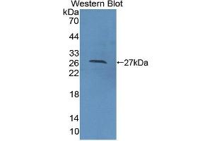 Western blot analysis of the recombinant protein. (CDC42 anticorps  (AA 1-188))