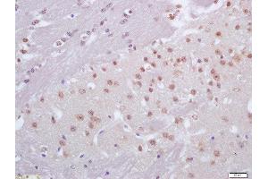 Formalin-fixed and paraffin embedded mouse brain labeled with Anti-CRX1 Polyclonal Antibody, Unconjugated  at 1:200 followed by conjugation to the secondary antibody and DAB staining