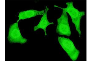 Immunofluorescence of monoclonal antibody to TRIP10 on HeLa cell. (TRIP10 anticorps  (AA 231-329))