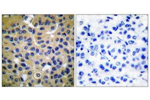 Immunohistochemistry (IHC) image for anti-Collagen, Type II (COL2) (N-Term) antibody (ABIN1848474)