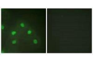 Immunofluorescence analysis of HeLa cells, using hnRNP L antibody.