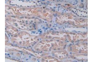 Figure. (TPSAB1 anticorps  (AA 161-262))