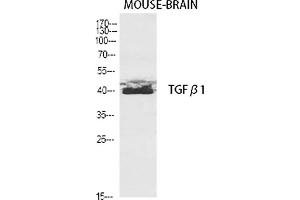Western Blot analysis of various cells using TGFβ1 Polyclonal Antibody diluted at 1:2000. (TGFB1 anticorps  (AA 310-390))
