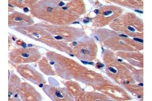 Detection of ICAM1 in Porcine Cardiac Muscle Tissue using Polyclonal Antibody to Intercellular Adhesion Molecule 1 (ICAM1)