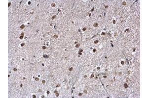 IHC-P Image KAP1 antibody [N1N2], N-term detects KAP1 protein at nucleus on mouse fore brain by immunohistochemical analysis. (KAP1 anticorps  (N-Term))