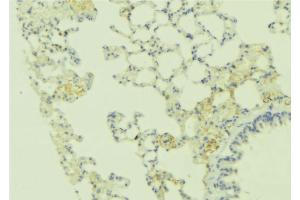 ABIN6269242 at 1/100 staining Human lung tissue by IHC-P. (CASR anticorps  (C-Term))