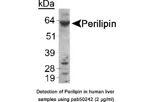Image no. 1 for anti-Perilipin 1 (PLIN1) (C-Term) antibody (ABIN363551) (PLIN1 anticorps  (C-Term))
