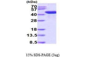 SDS-PAGE (SDS) image for Histone Deacetylase 8 (HDAC8) (AA 1-377) protein (His tag) (ABIN6387962)
