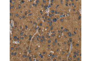 Immunohistochemistry (IHC) image for anti-Hydroxysteroid (17-Beta) Dehydrogenase 2 (HSD17B2) antibody (ABIN2430252) (HSD17B2 anticorps)