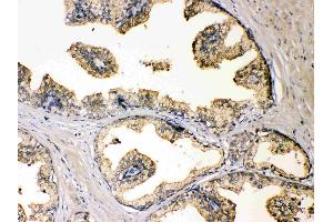 IHC analysis of DBI using anti-DBI antibody .