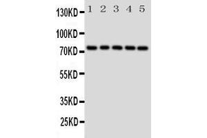 Western Blotting (WB) image for anti-Heat Shock 70kDa Protein 9 (Mortalin) (HSPA9) (AA 591-609), (C-Term) antibody (ABIN3043052) (HSPA9 anticorps  (C-Term))