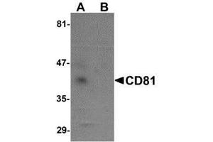 Western blot analysis of CD81 in human lung tissue lysate with AP30217PU-N CD81 antibody at 1 μg/ml in (A) the absence and (B) the presence of blocking petide. (CD81 anticorps  (N-Term))