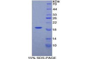 SDS-PAGE analysis of Rat alpha Lactalbumin Protein. (LALBA Protéine)