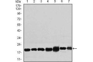 Western blot analysis using RPL18A mouse mAb against NIH3T3 (1), HEK293 (2), HL60 (3), Jurkat (4), Raji (5), MOLT4 (6), and HeLa (7) cell lysate. (RPL18A anticorps  (AA 50-176))