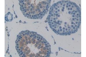 Detection of TACR2 in Rat Testis Tissue using Polyclonal Antibody to Tachykinin Receptor 2 (TACR2)