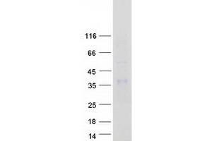 Validation with Western Blot