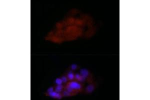 Immunofluorescence analysis of HepG2 cells using TI Rabbit pAb (2523) at dilution of 1:100 (40x lens). (TIA1 anticorps  (C-Term))