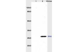 L1 rat brain, L2 rat kidney lysates probed (ABIN741555) at 1:200 in 4 °C.