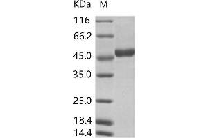 Zika Virus NS1 (ZIKV NS1) protein (His tag)