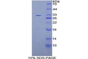 SDS-PAGE analysis of Rat Oncostatin M Receptor Protein.