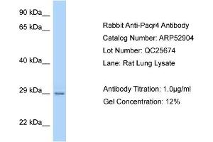 Western Blotting (WB) image for anti-Progestin and AdipoQ Receptor Family Member IV (PAQR4) (C-Term) antibody (ABIN2785146) (PAQR4 anticorps  (C-Term))
