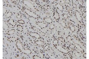 ABIN6262196 and ABIN6278236 at 1/100 staining Human kidney tissue by IHC-P. (HDLBP anticorps  (N-Term))