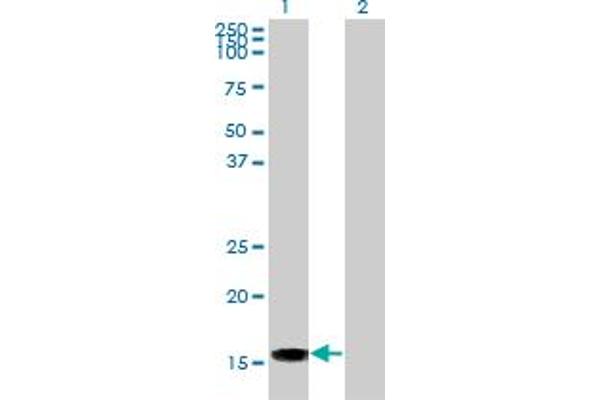 ACP1 抗体  (AA 1-158)